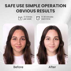 gelpal mask worn on the face highlights 60+ zones for targeted care.