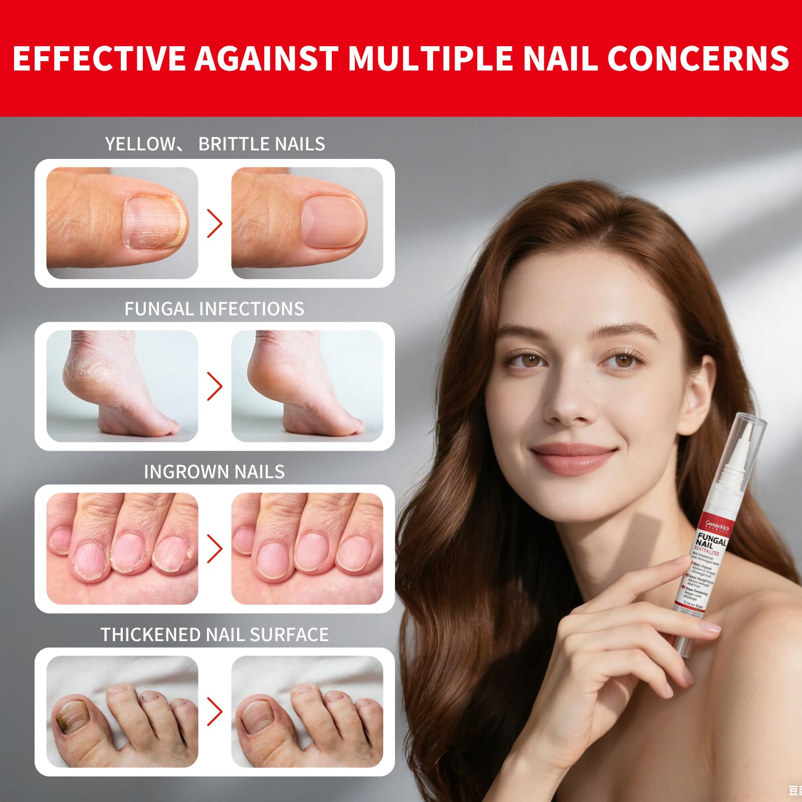 Gemächlich ZuHause Toenail Fungus Pen daily-use routine for healthier-looking nails.