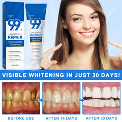 Generic Hydroxyapatite Toothpaste relieves sensitivity for daily brushing.