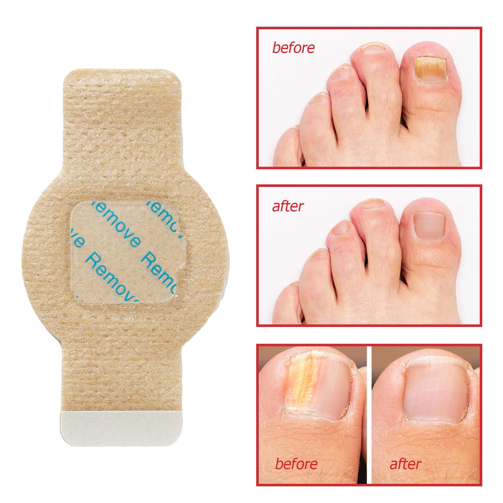 Generic Nail Patches breathable hydrogel formula for lightweight wear