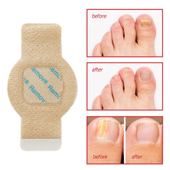 Generic Nail Patches breathable hydrogel formula for lightweight wear