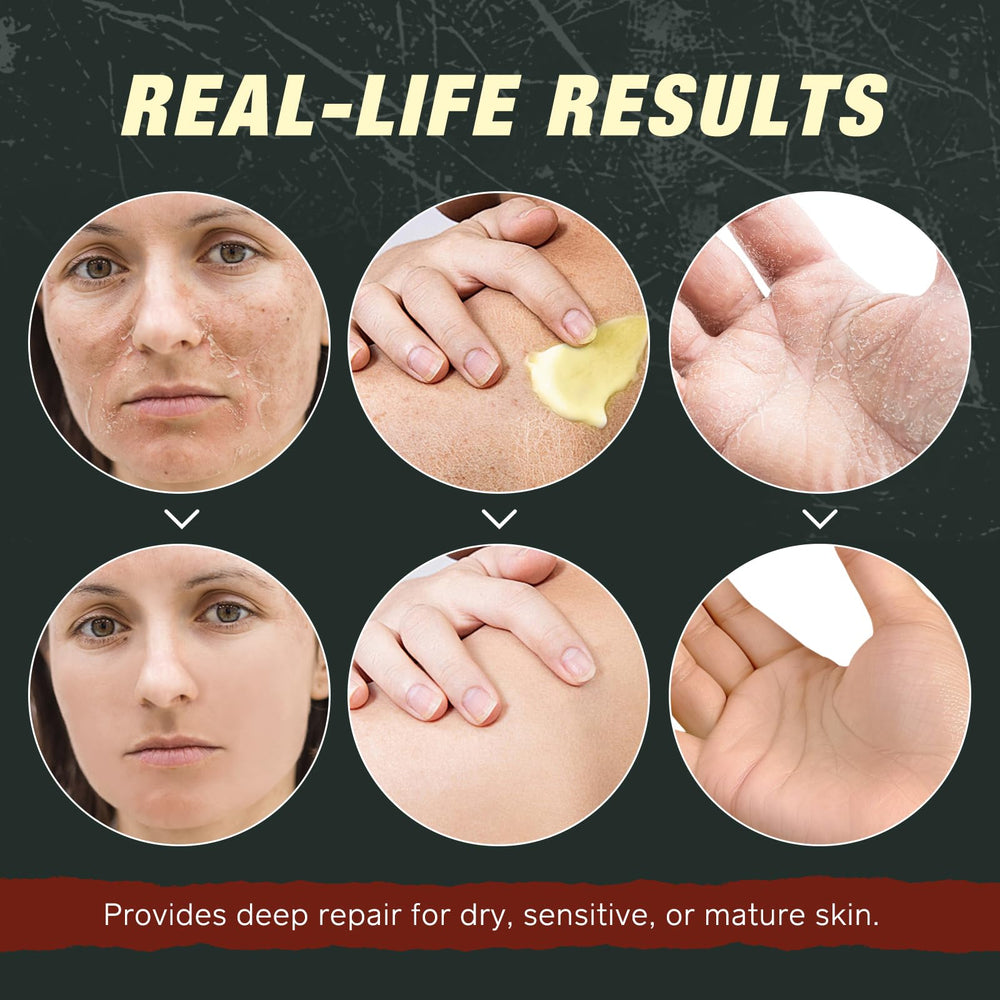 Generic Beeswax barrier moisturizer locks in moisture while breathable