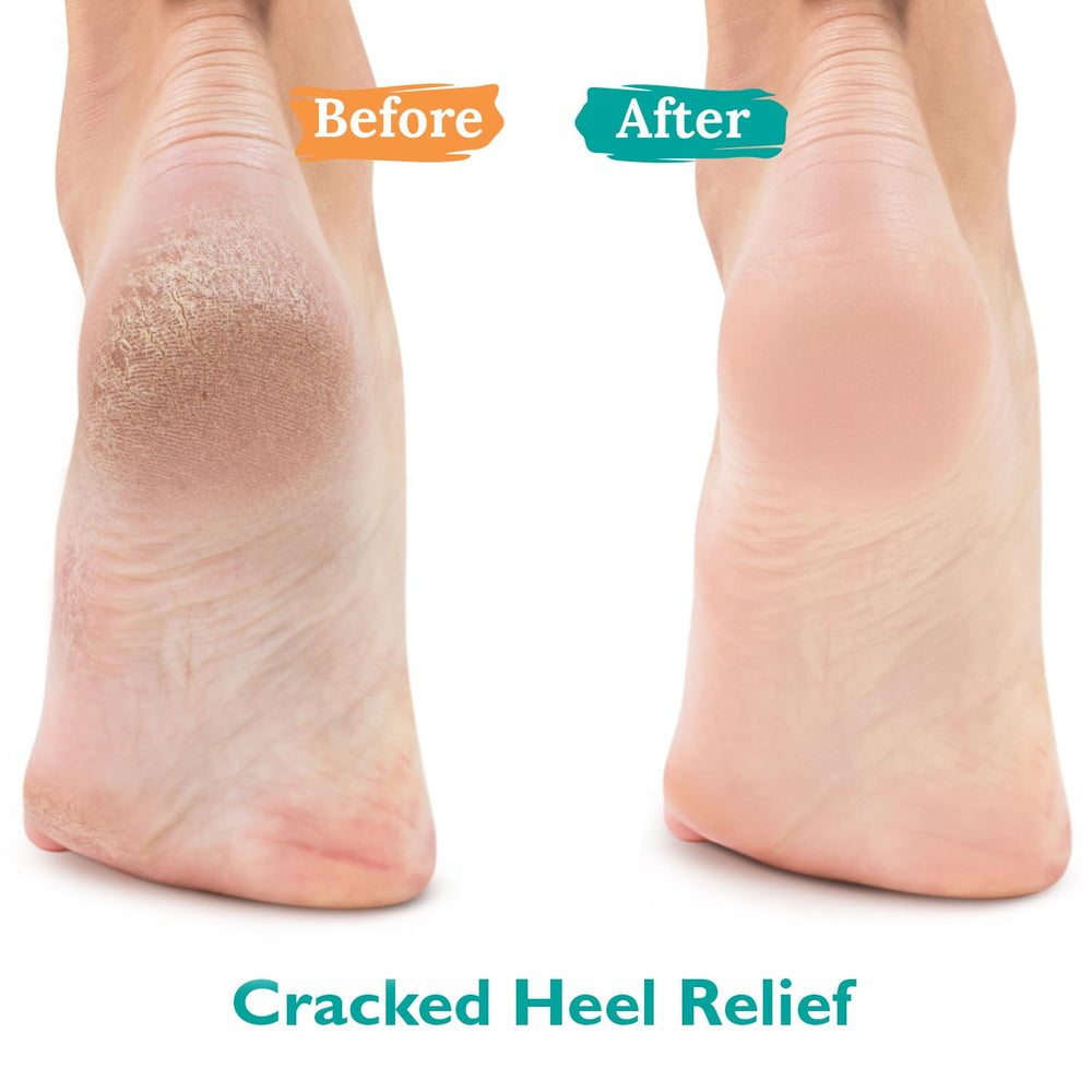 Close-up of GILDEN TREE Urea Gel 42% with a clear, oil-free formula