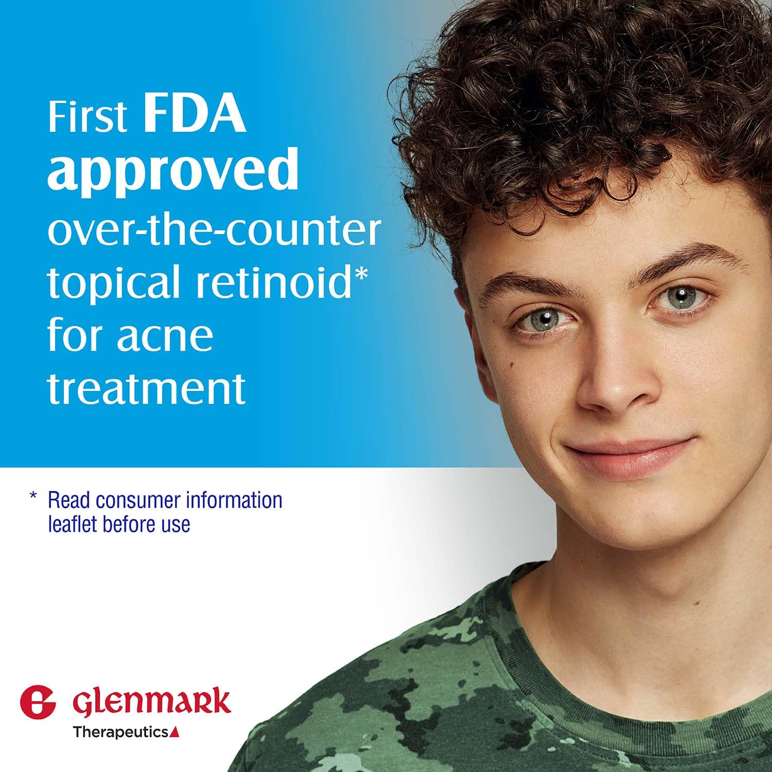 Glenmark Adapalene Gel on skin helps clear pores and prevent breakouts