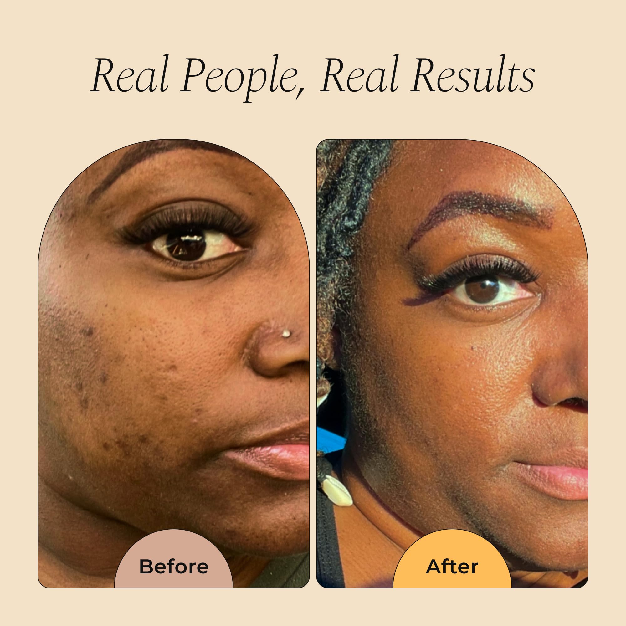 Glo Melanin turmeric scrub on face in use demonstrates gentle brightening.