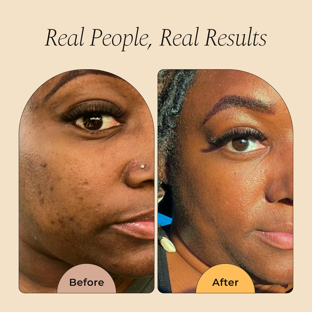 Glo Melanin turmeric scrub on face in use demonstrates gentle brightening.