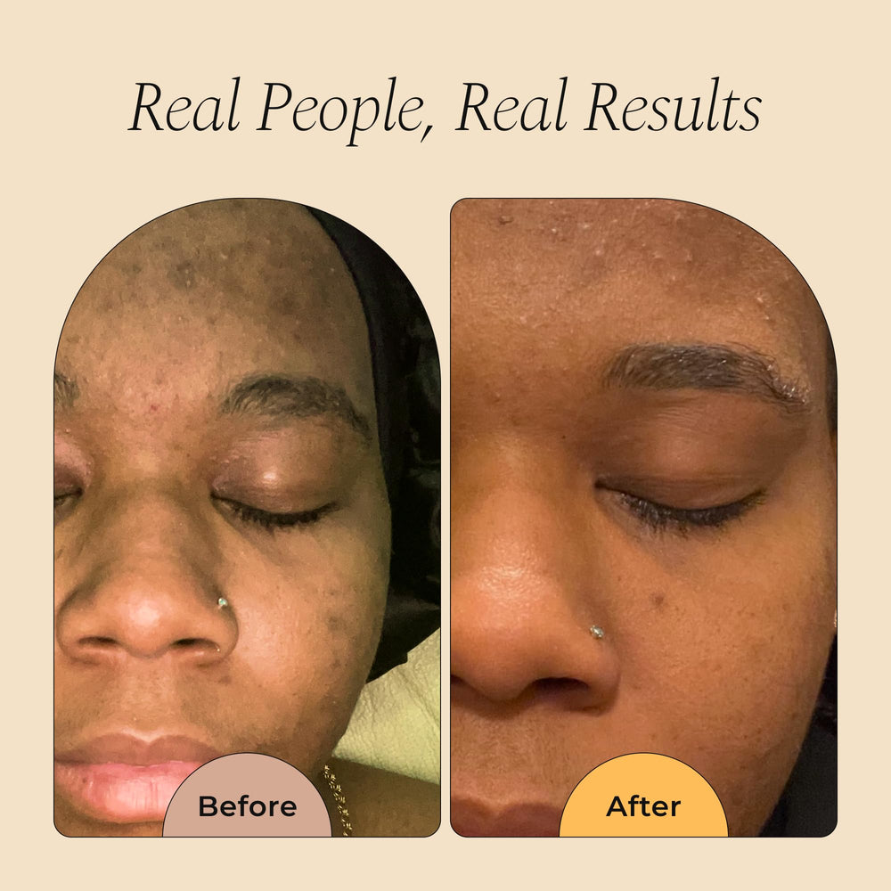 Lathering with Glo Melanin turmeric soap for rich cleansing foam.