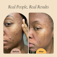 Glo Melanin vitamin C brightening foam texture showing fresh glow after use.