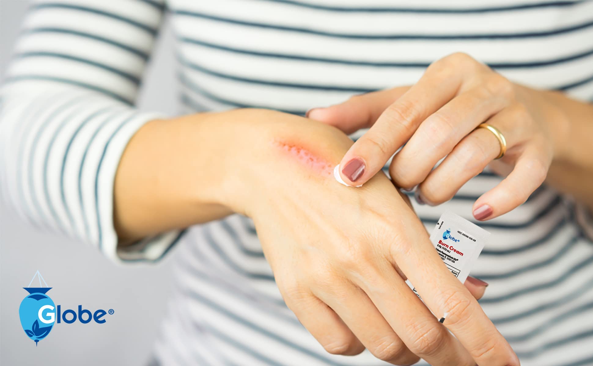 Globe Burn Cream travel kit demonstrates convenient on-the-go care.