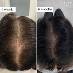 Glov Beauty gold derma stamp head demonstrating precise micro-stimulation.