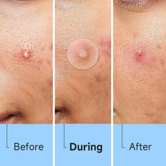 Glowpatch overnight adhesion keeps patches in place through sleep and movement.