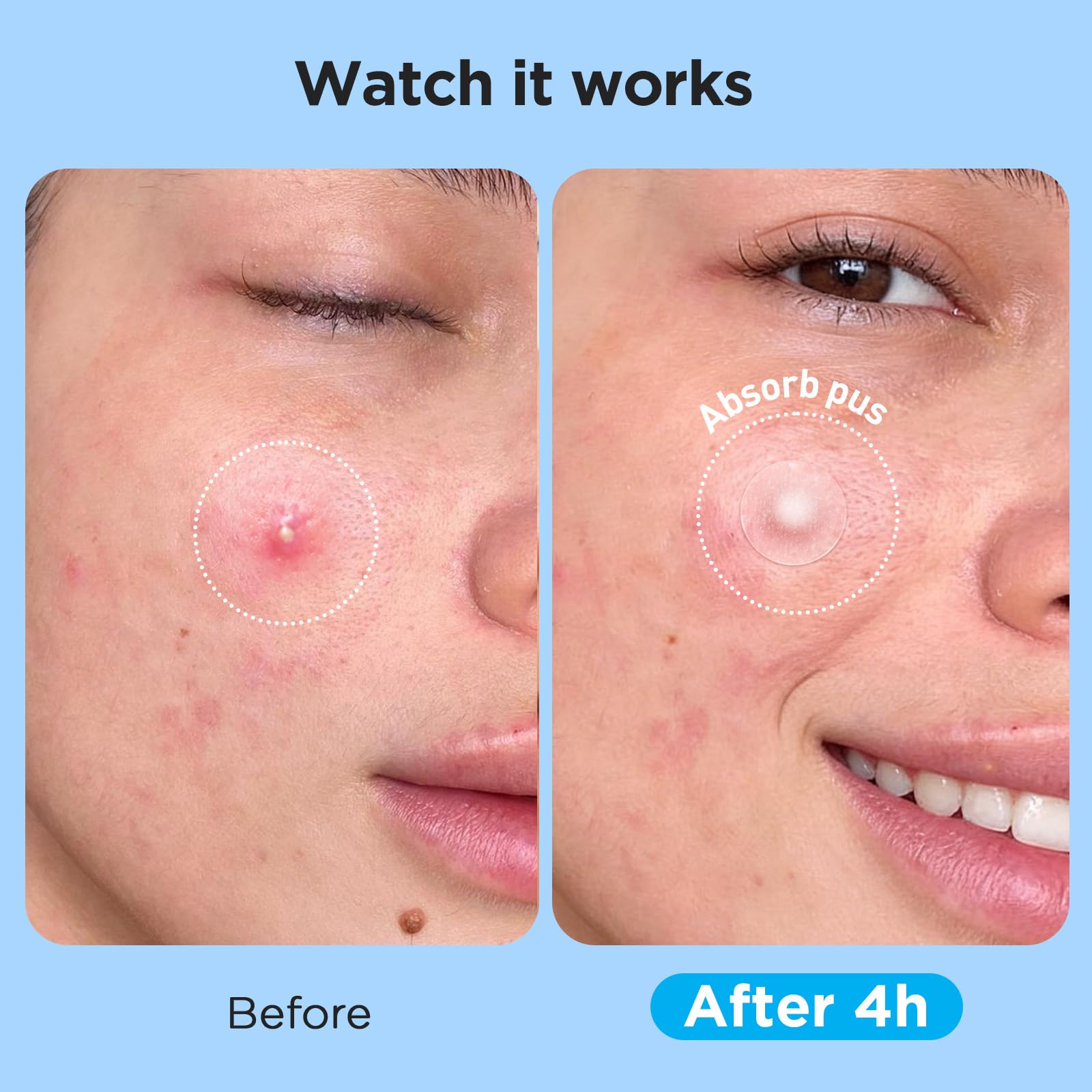 Glowpatch stays on overnight with strong adhesion.
