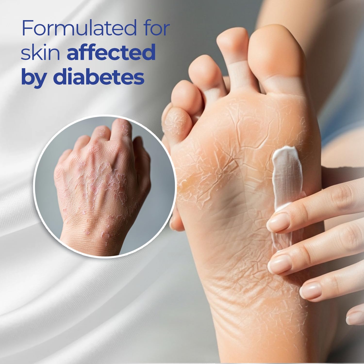 Goicoechea Diabet TX lotion for elbows nourishes dry areas with aloe.