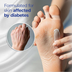 Goicoechea Diabet TX lotion for elbows nourishes dry areas with aloe.