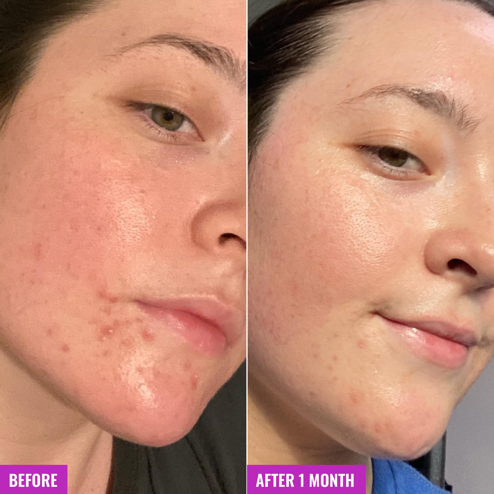Good Molecules Clarify and Cleanse Bar on face and body during cleansing routine.