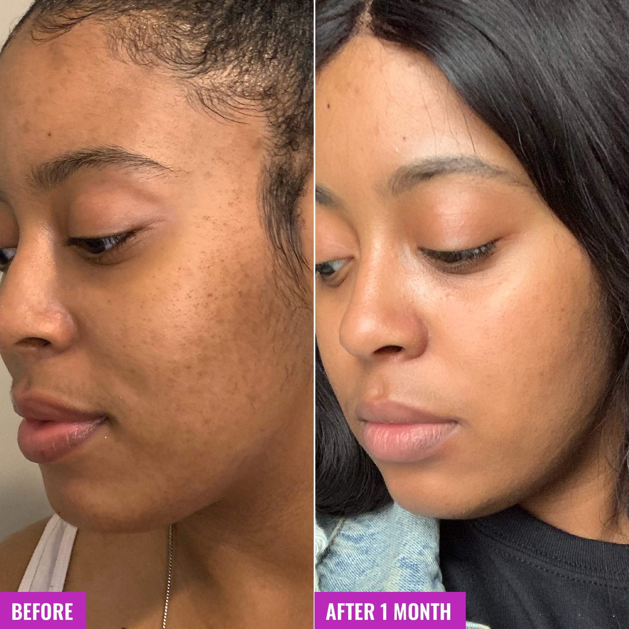 Good Molecules Glycolic Exfoliating Toner hyaluronic acid highlighting hydration for plump skin