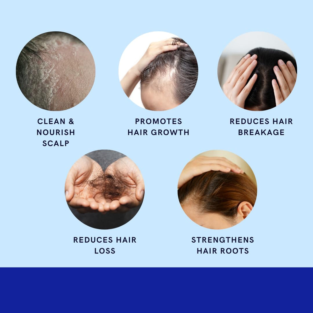 Green Royalty Minoxidil Shampoo no-dyes-added formula suits sensitive scalps.
