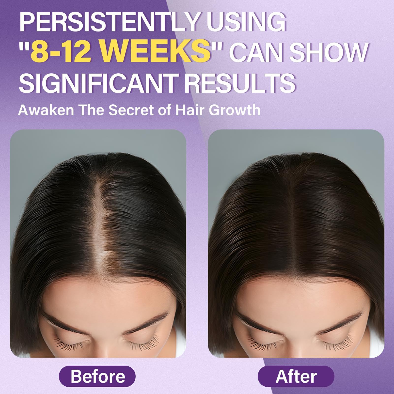 Greoay minoxidil foam application on the scalp for targeted care.