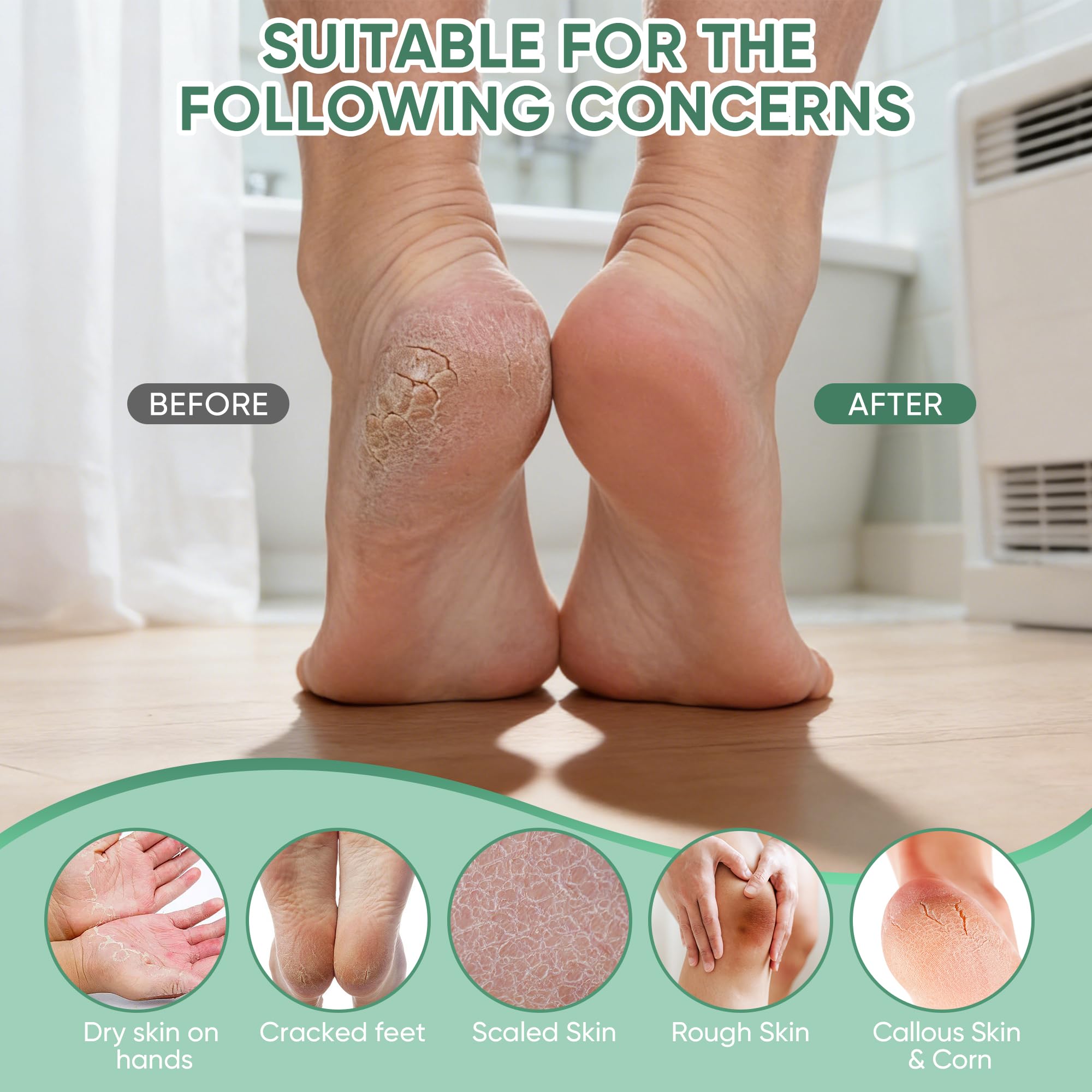 Grocerism Urea Cream for feet, hands, elbows—multi-area hydration.