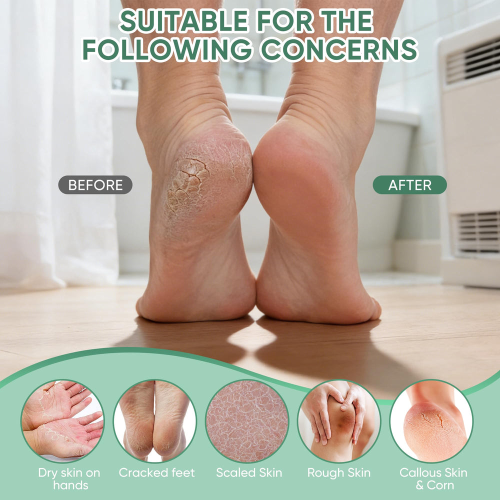 Grocerism Urea Cream for feet, hands, elbows—multi-area hydration.