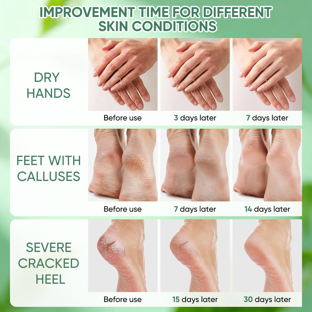 Grocerism Urea Cream with tea tree and aloe soothes and repairs skin barrier.