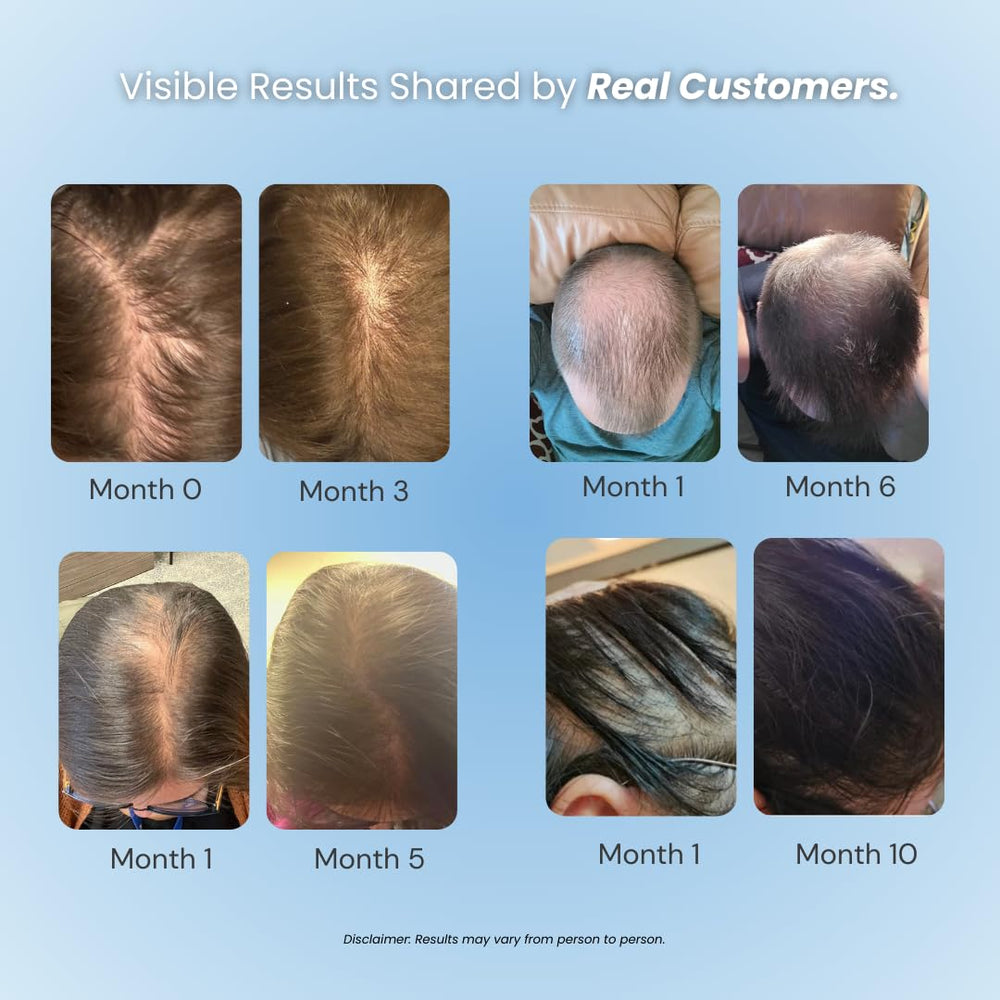 Growplex Vitafoam quick-drying non-greasy foam ideal for daily styling.