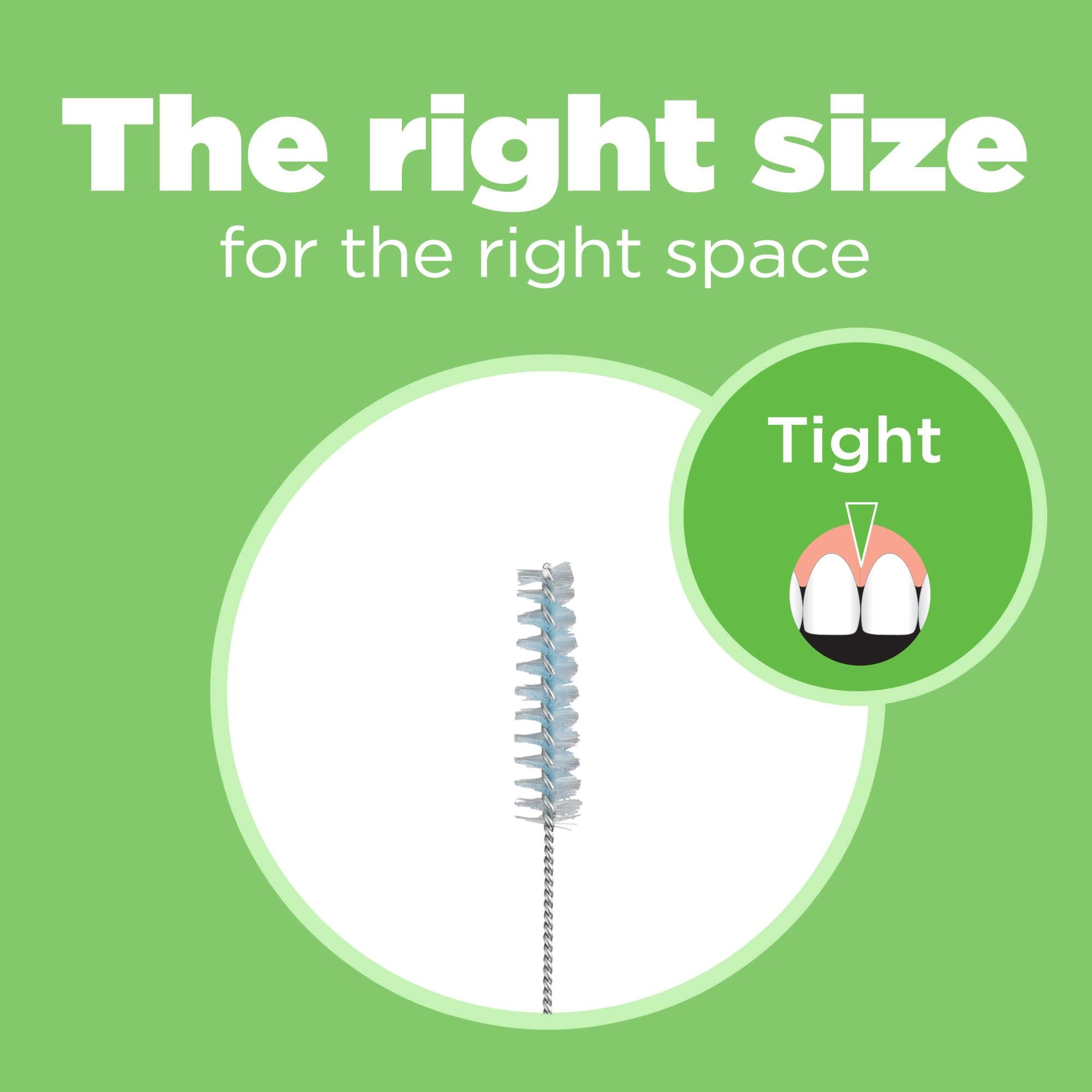 Nylon-coated wire protects braces and implants during interdental cleaning.