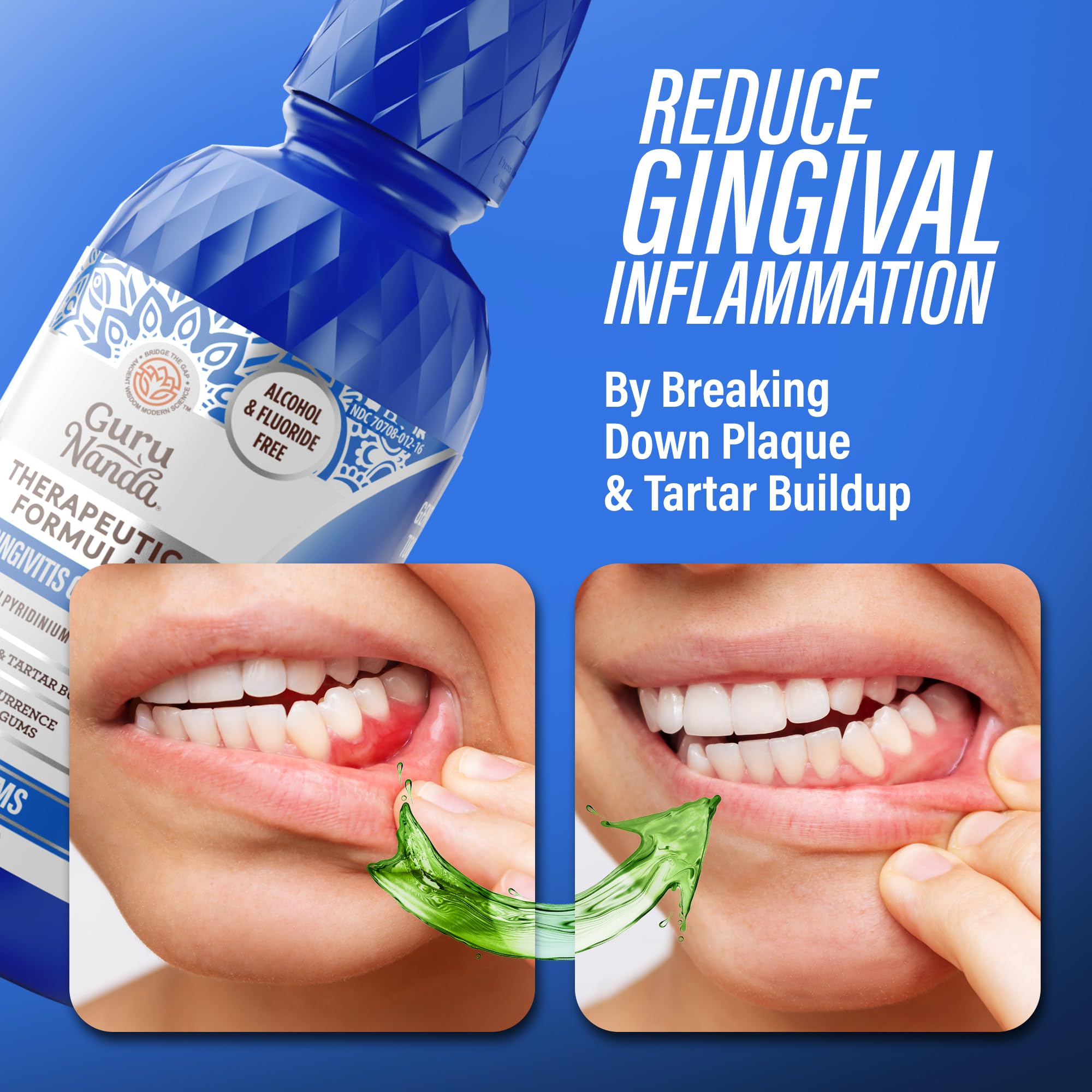 GuruNanda mouthwash between brushing and flossing for ongoing gum care.