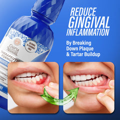 GuruNanda mouthwash between brushing and flossing for ongoing gum care.