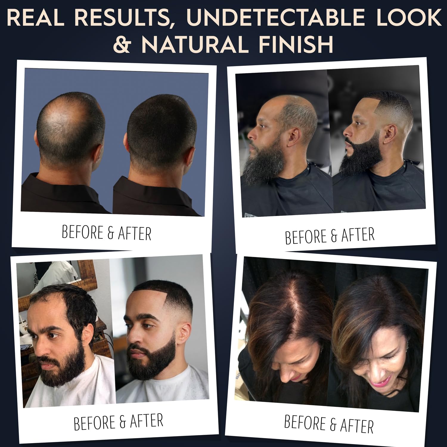 Hair Illusion thinning hair coverage creates a denser appearance.