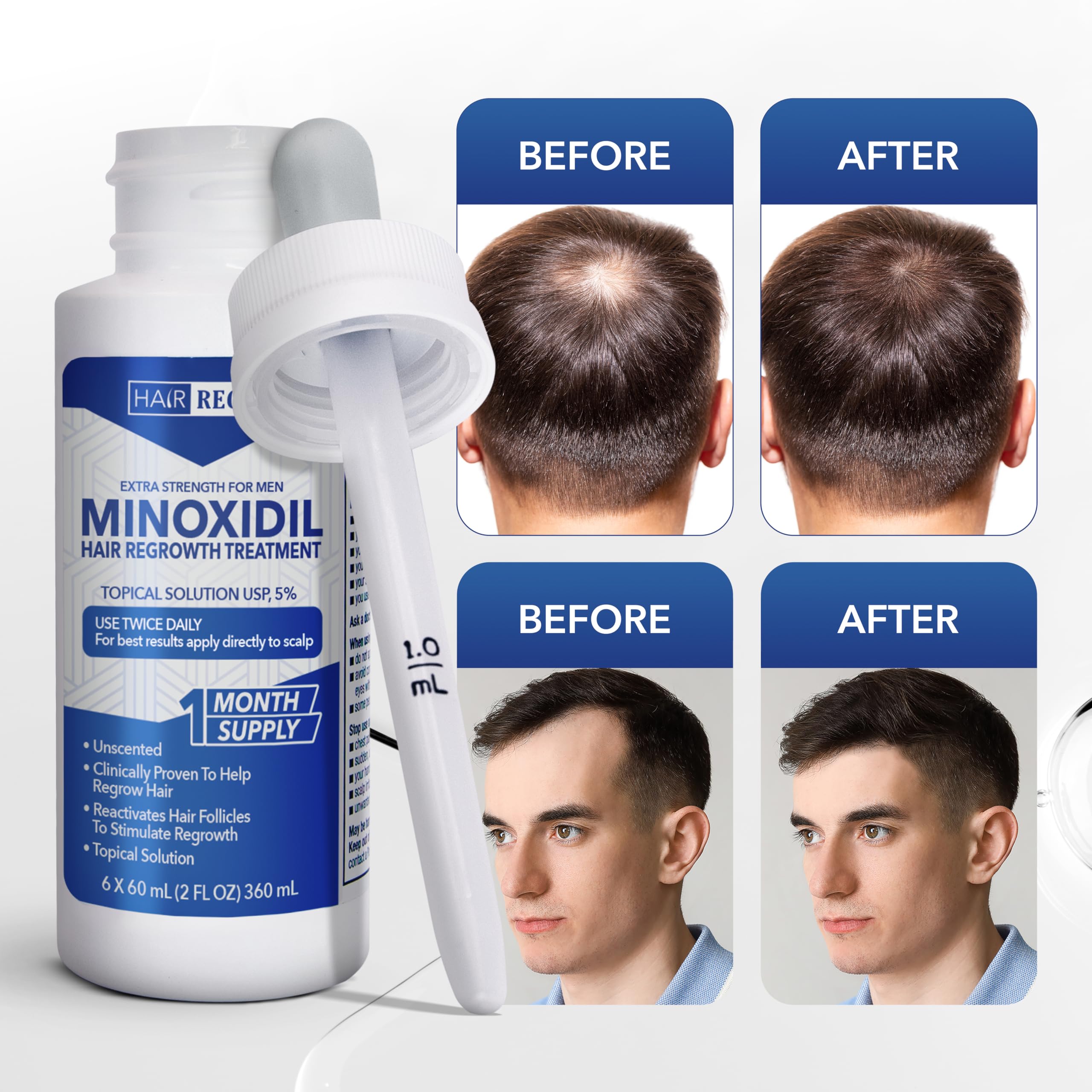 Hair Regen 6-bottle-pack representing six-month supply.