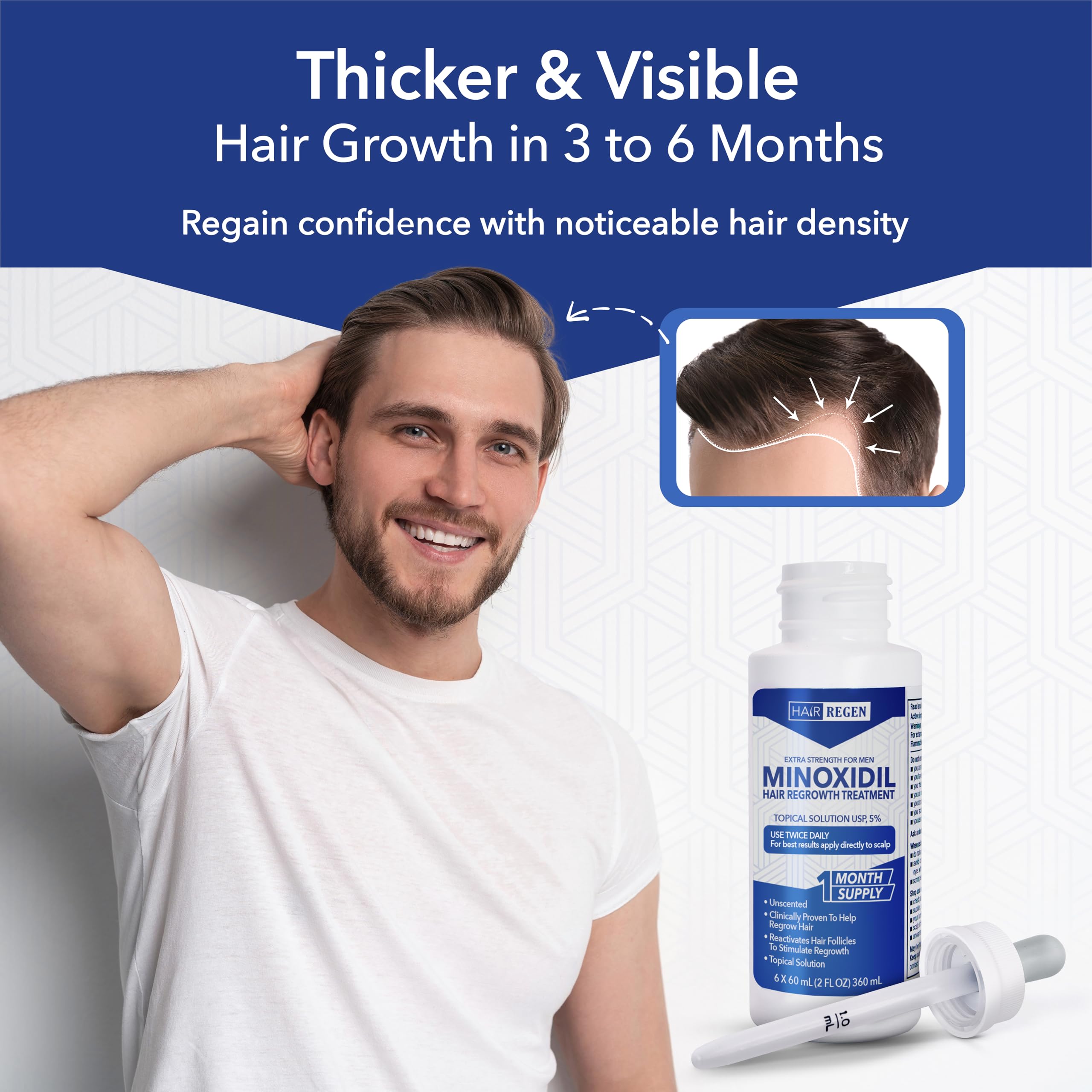 Hair Regen before-after montage illustrating visual hair trend.
