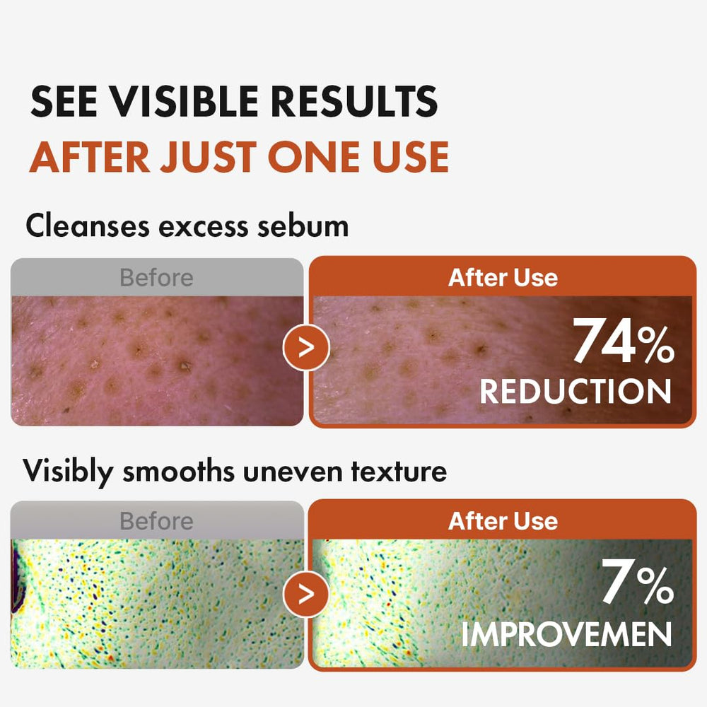 Emulsification moment of Hanskin BHA Pore Cleansing Oil with water