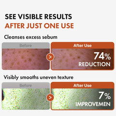 Emulsification moment of Hanskin BHA Pore Cleansing Oil with water