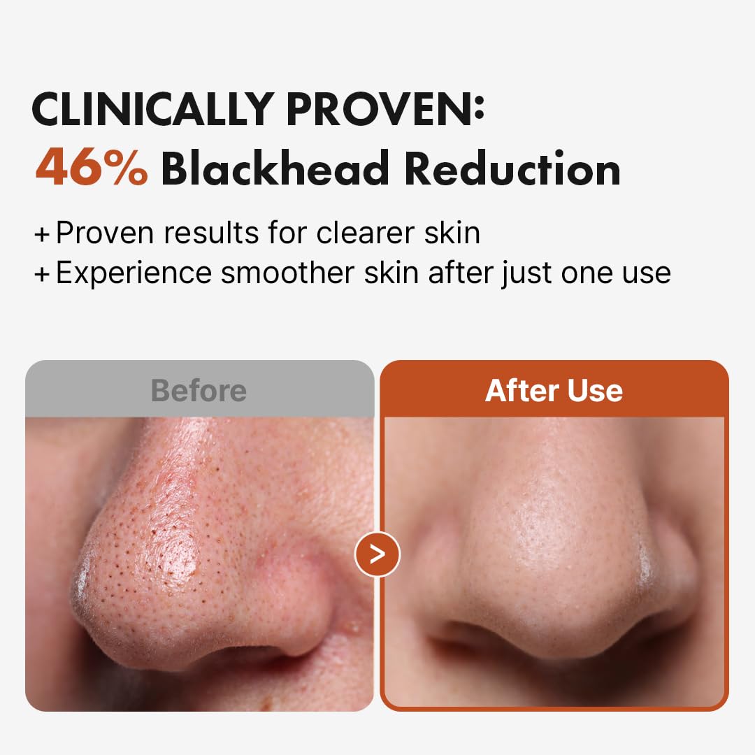 Hand performing massage with Hanskin BHA Pore Cleansing Oil