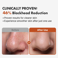 Hand performing massage with Hanskin BHA Pore Cleansing Oil