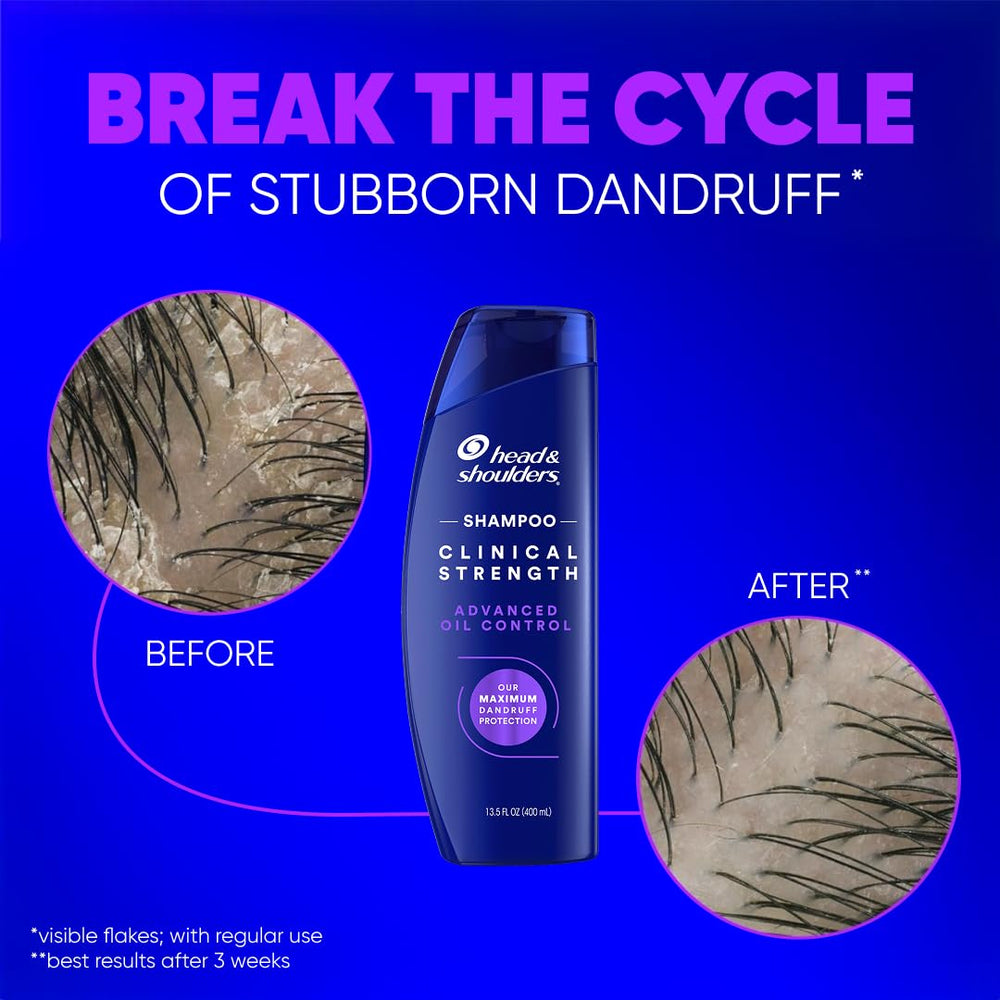 Head & Shoulders Clinical Strength oil control image showing long-lasting dandruff protection.
