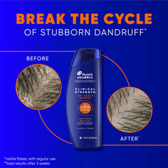 Head & Shoulders dandruff-defense conditioner tube paired with shampoo