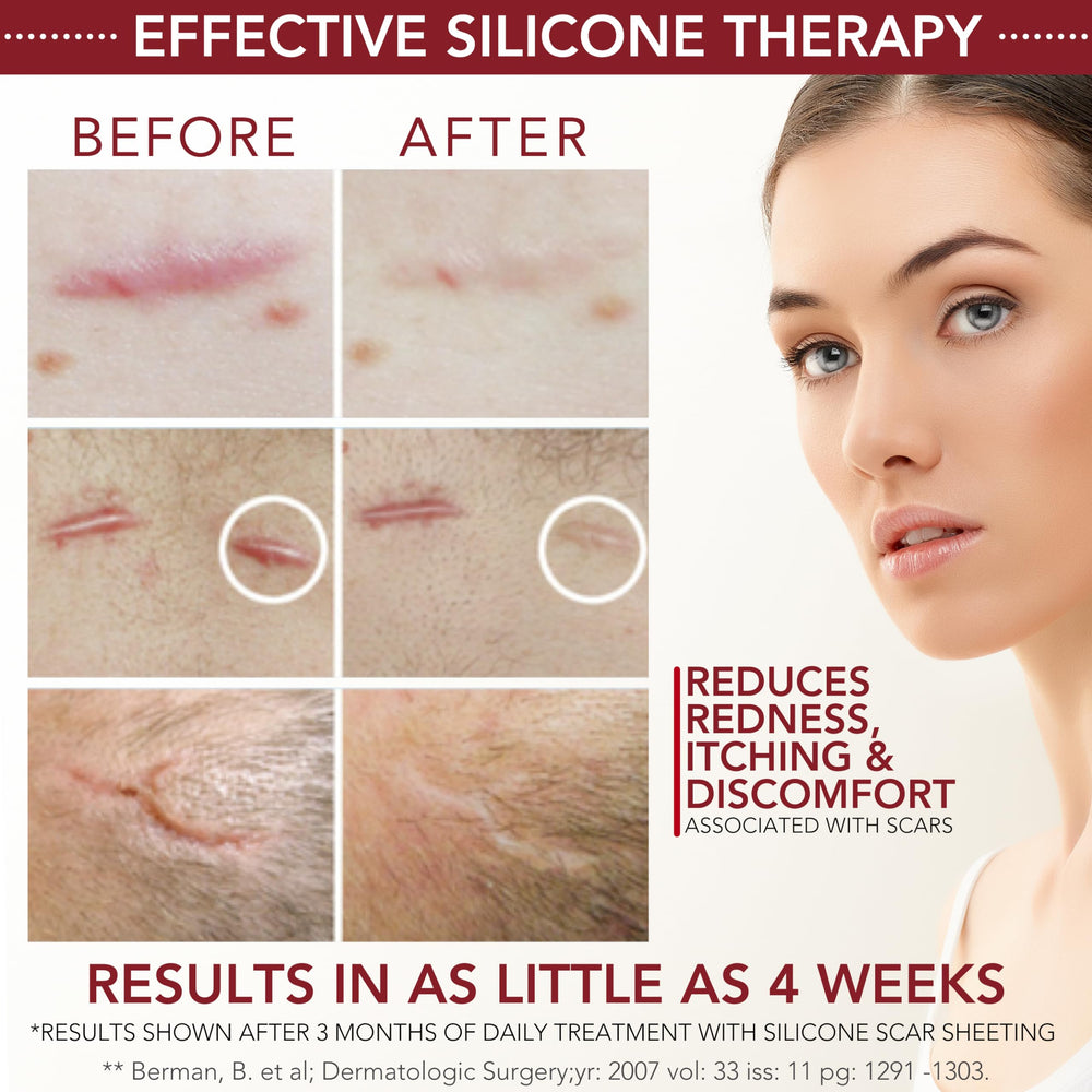 HealFast scar gel multi-use application demonstrates versatility on surgical and burn scars