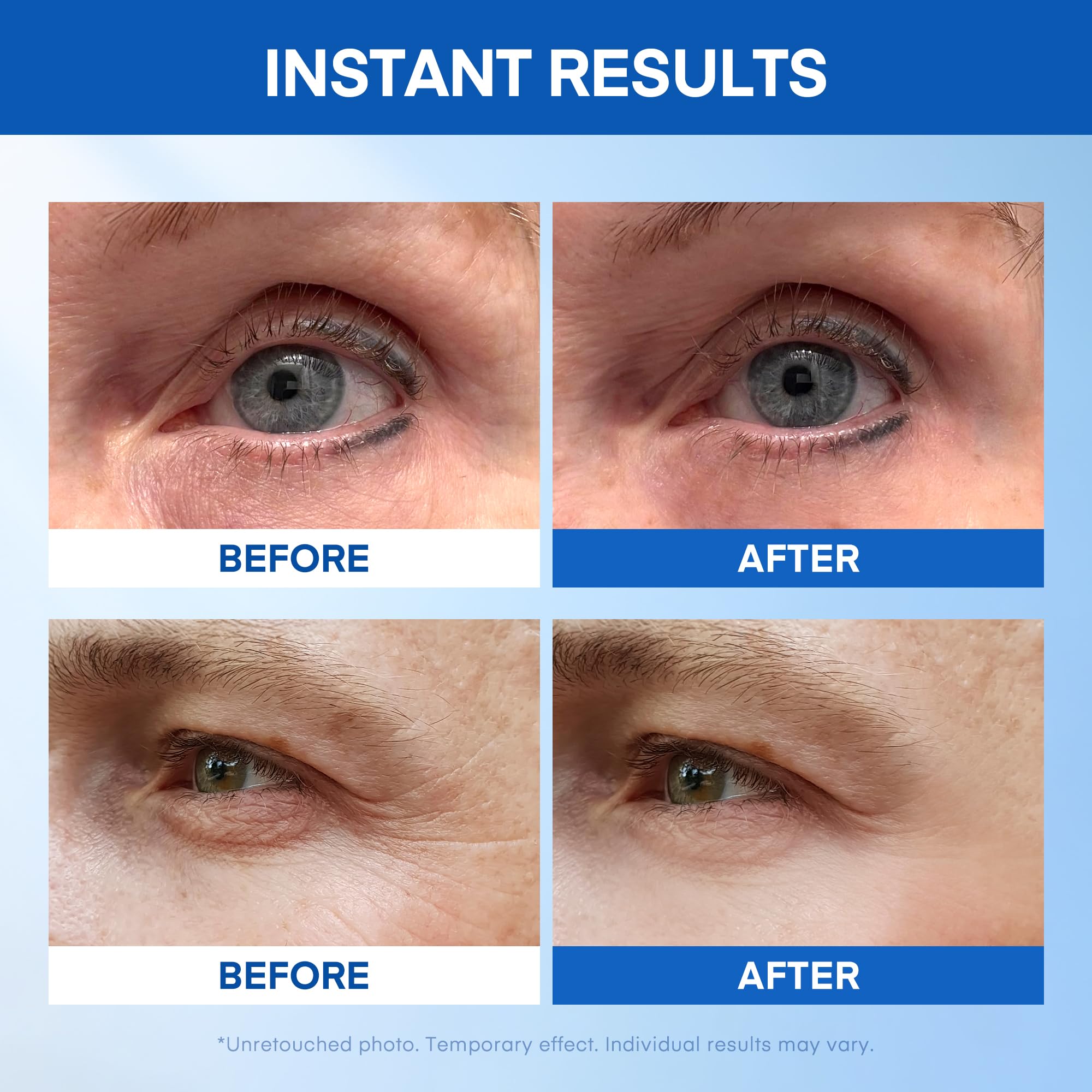HealthyDerm Instant Eye Lift Serum applied under the eye for a smoother look.