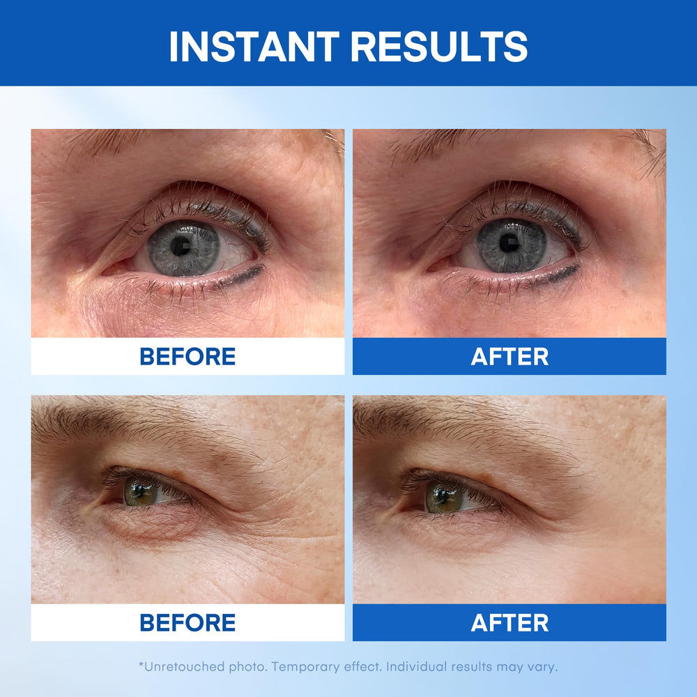 HealthyDerm Instant Eye Lift Serum applied under the eye for a smoother look.