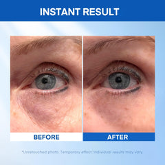 HealthyDerm eye area smoothing close-up ready for makeup with even coverage
