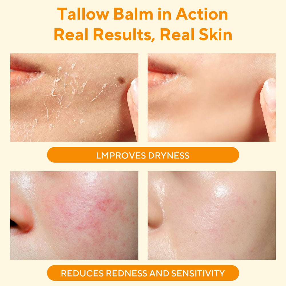 Natural ingredients highlight grass-fed tallow and bees honey in Henjaca balm.