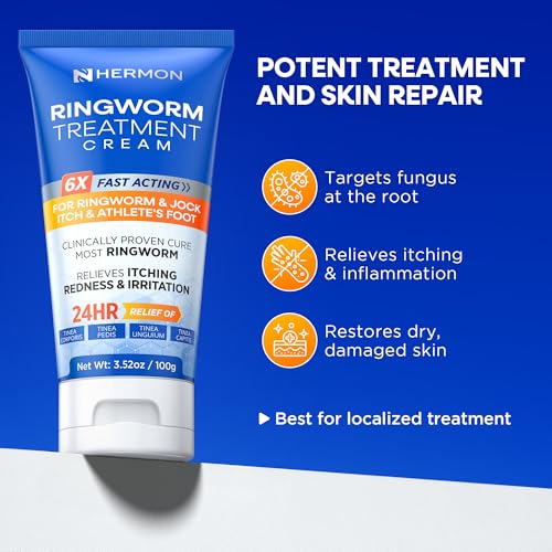 Hermon Antifungal Cream suitable for adults and kids.
