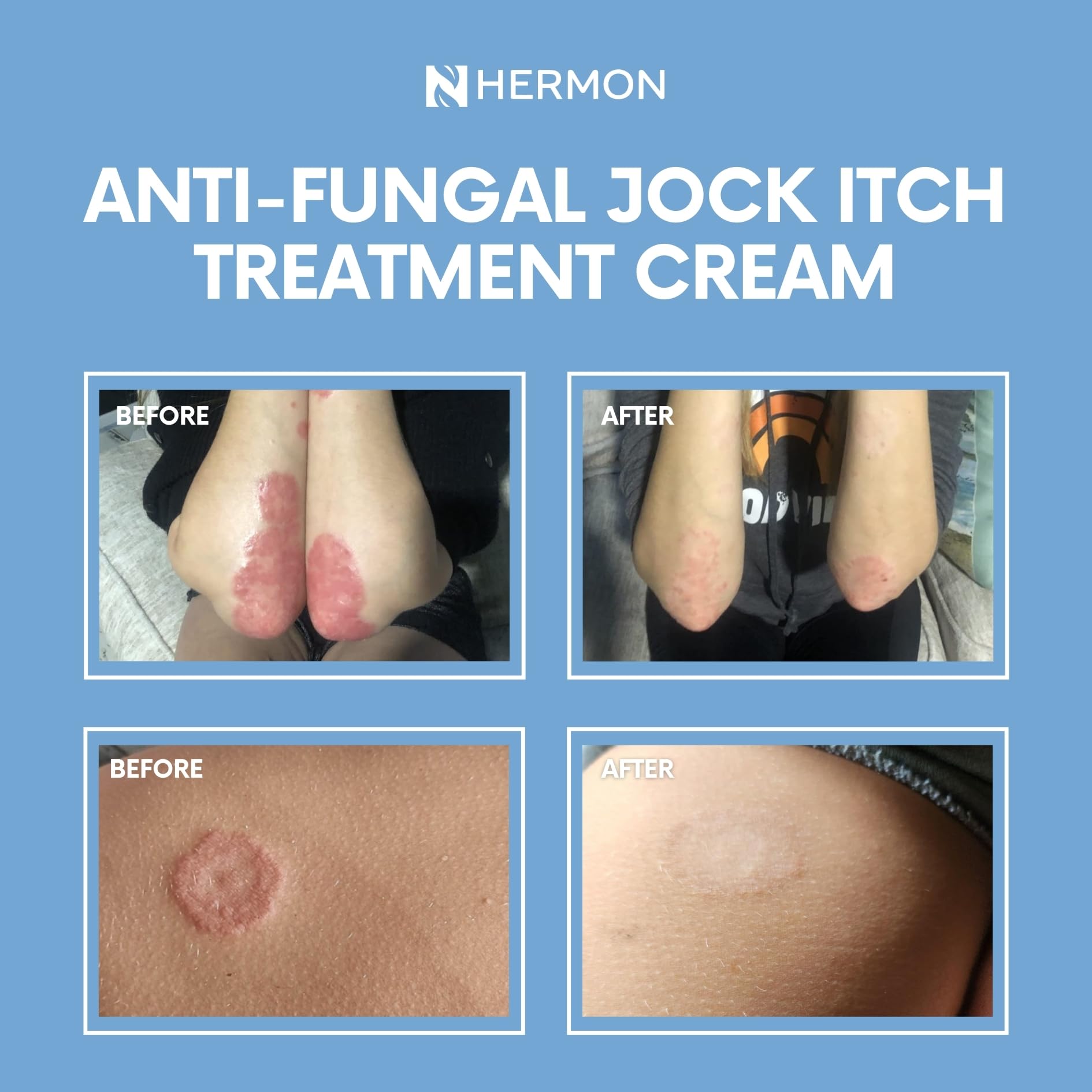 Product shown on skin, suitable for face and body.