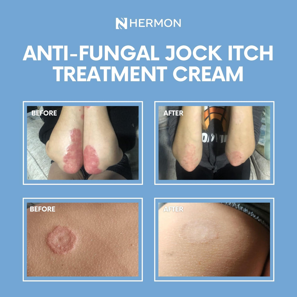 Product shown on skin, suitable for face and body.
