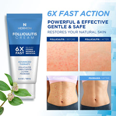 Hermon Folliculitis Cream jar closeup showing smooth texture for sensitive skin.