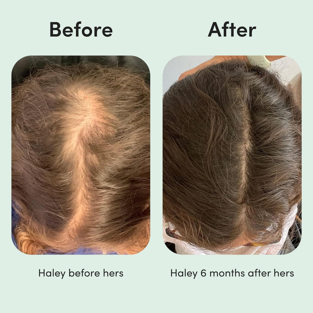 Hims & Hers Hair Regrowth non-greasy finish after application dries clear