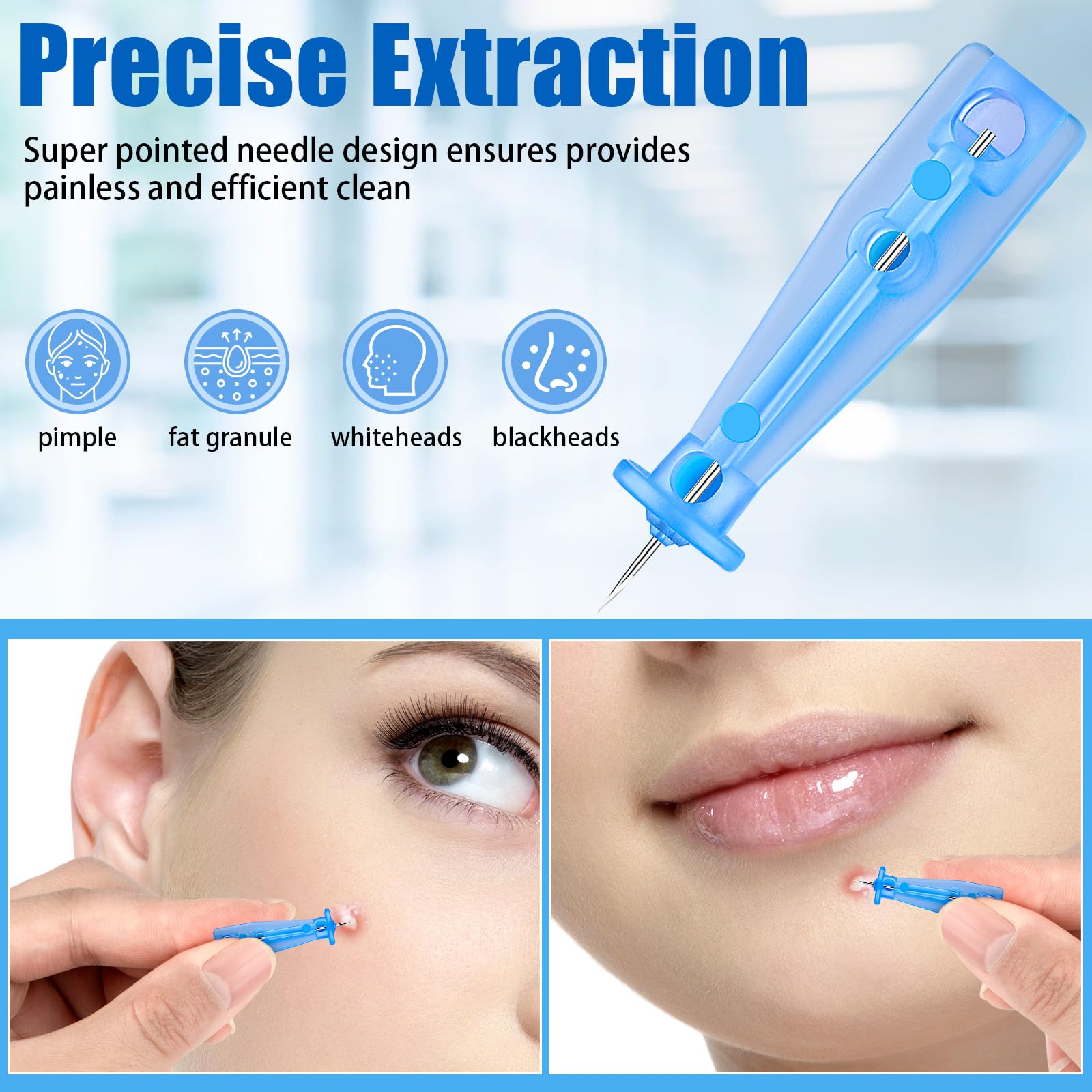 HFYHWT disposable pimple needles pack for hygienic extractions