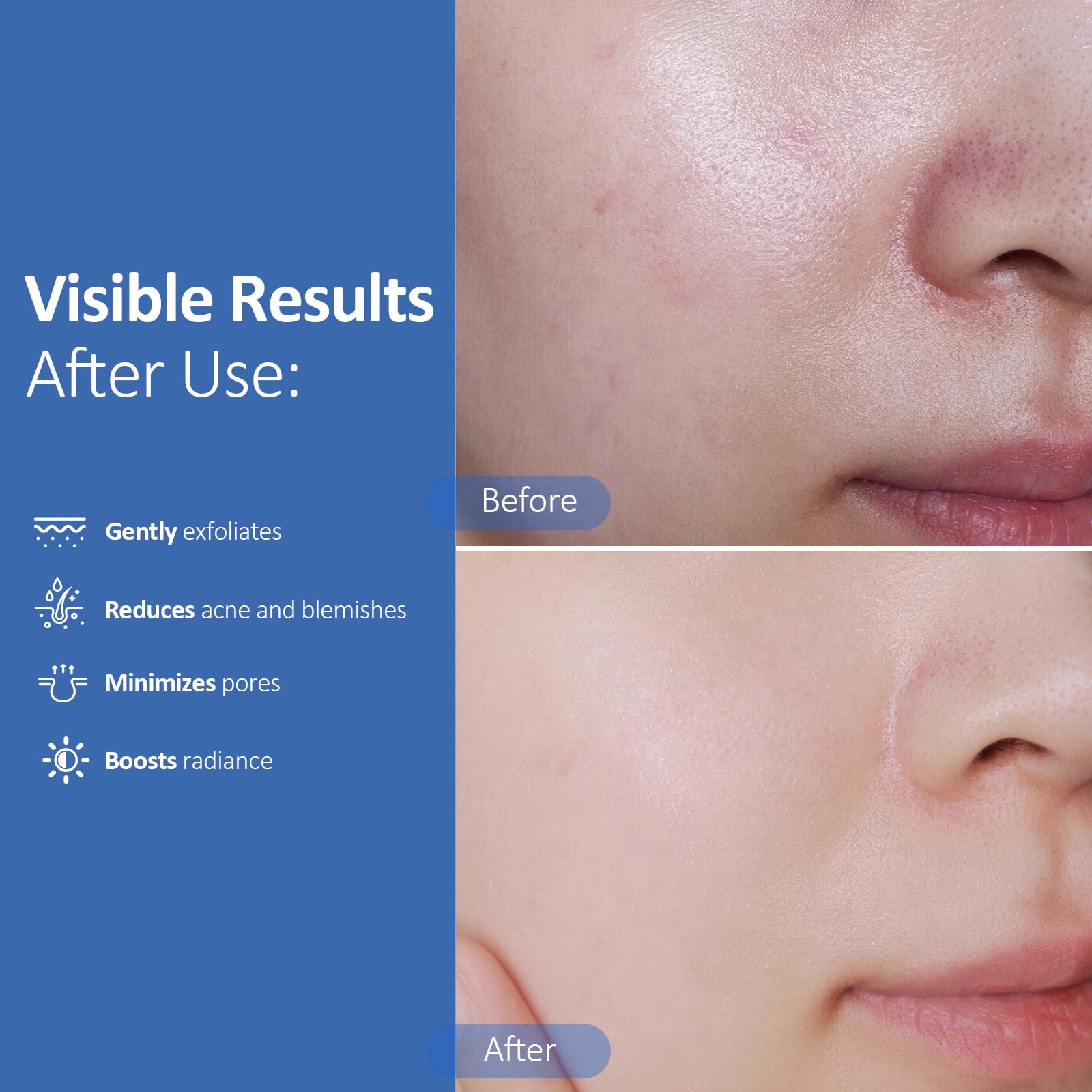 Hicream Glycolic Acid Pads tube and pads view for easy post-cleansing toning